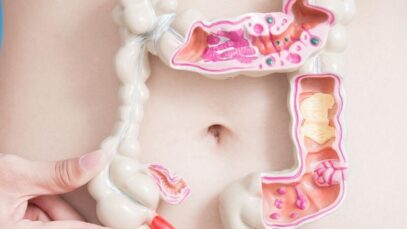 flora intestinal