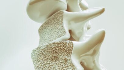 Osteoporose