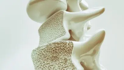 Osteoporose