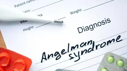 Síndrome de Angelman