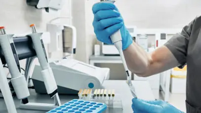 Teste rápido de HIV