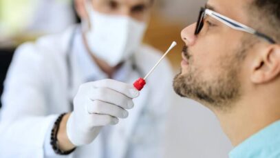 Rede de farmácias tem procura 50% maior por testes de Covid