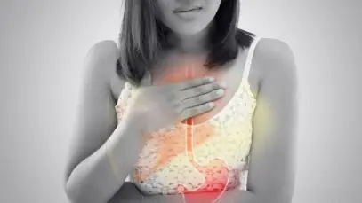 refluxo gastroesofágico