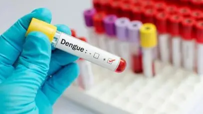 Dengue