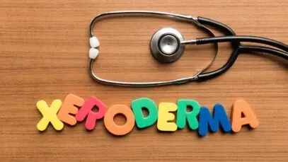 xeroderma pigmentoso