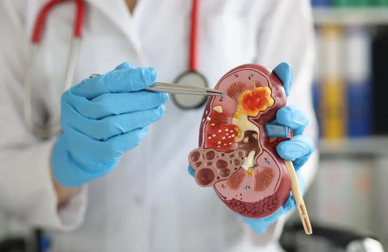 Design sem nome – 2023-11-10T135700.256 Urologia