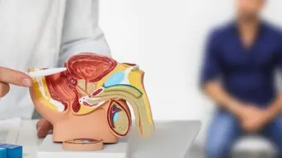 câncer de próstata