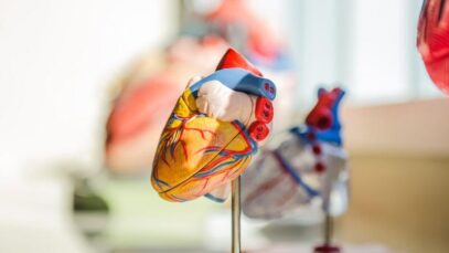 Cardiopatia congênita