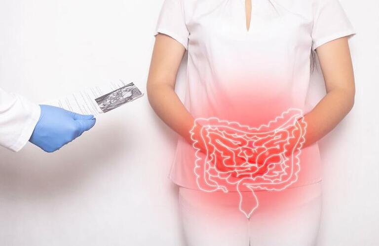 O guia definitivo para entender o câncer de intestino