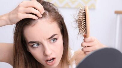 Alopecia