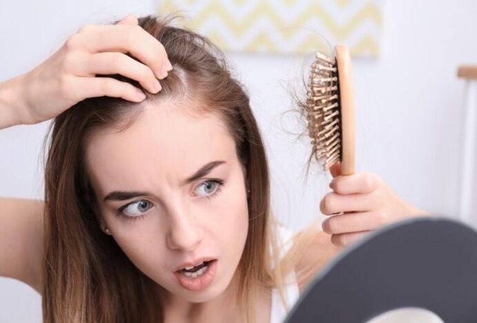 Alopecia