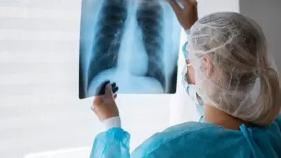 pneumonia é contagiosa