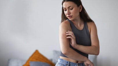 mulher-que-sofre-de-erupcao-cutanea alergia de pele