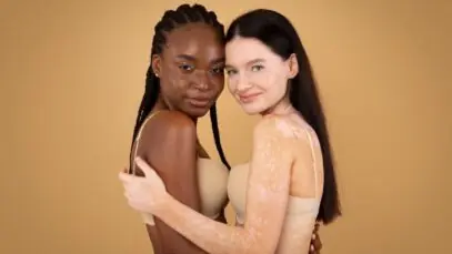 perda de coloração da pele