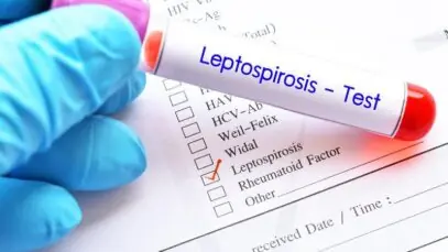 Novo teste para leptospirose