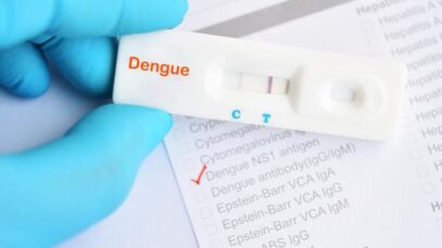 DPSP registra 2000% de crescimento em exames de dengue