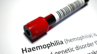 Tratamento para hemofilia unirá farmacêutica e poder público