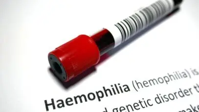 Tratamento para hemofilia unirá farmacêutica e poder público