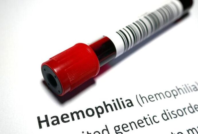 Tratamento para hemofilia