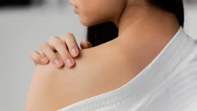 molusco contagioso