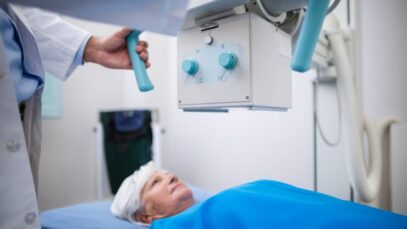 como funciona a radioterapia