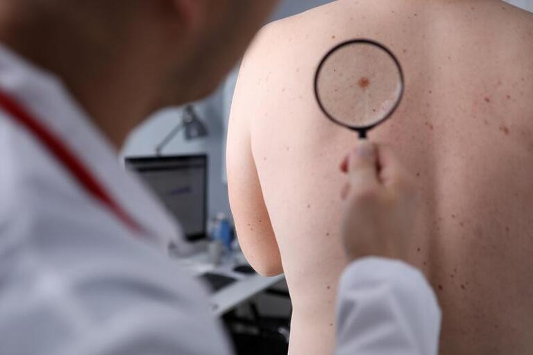 Moderna e MSD estudam vacina contra o câncer de pele