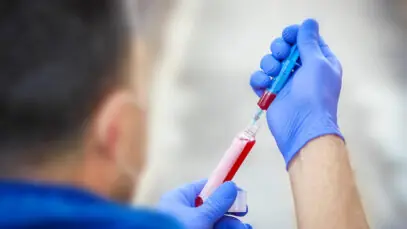 Teste pode facilitar o tratamento da esclerose múltipla