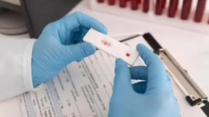 Testes rápidos de HIV