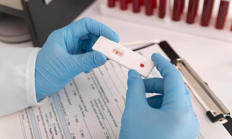 Testes rápidos de HIV