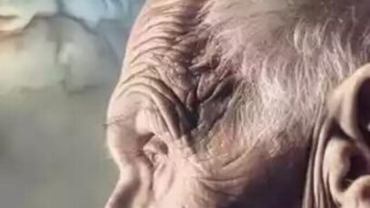 Alzheimer