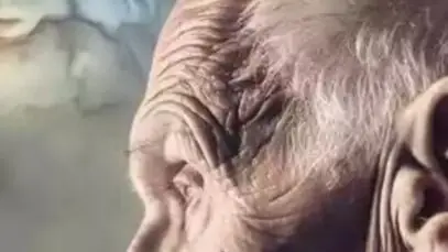 Alzheimer