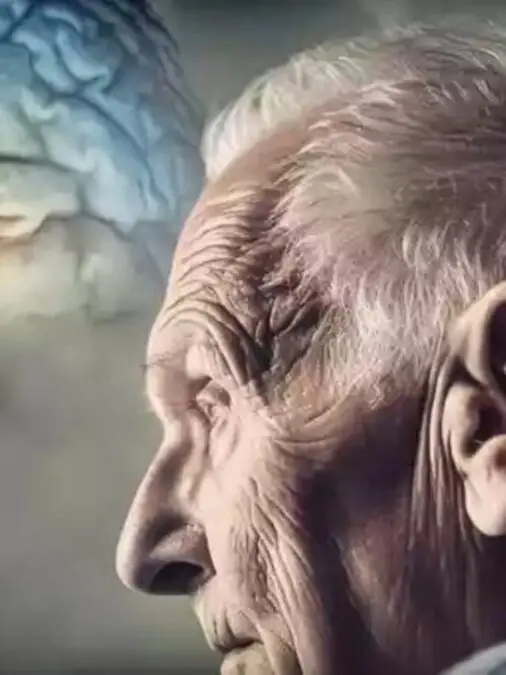 Medicamentos para Alzheimer serão próxima aposta do setor farmacêutico Alzheimer