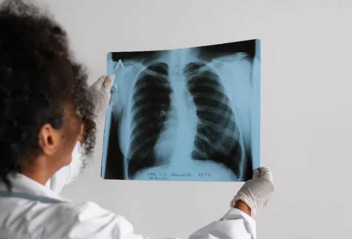 Unesp recebe R$ 14 milhões em projeto que vai testar inovação para o tratamento contra a tuberculose