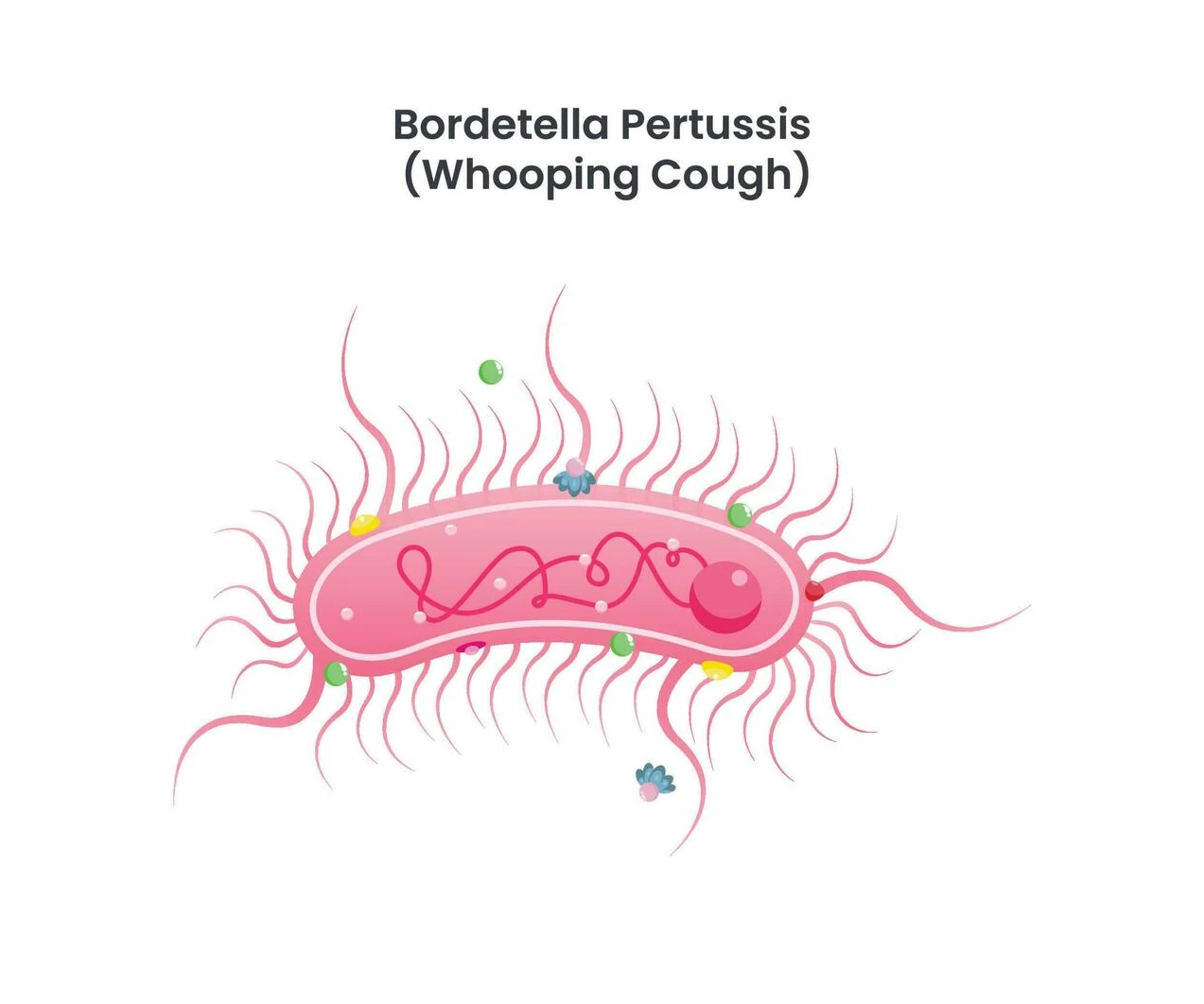 infecção respiratória aguda causada pela bactéria Bordetella pertussis