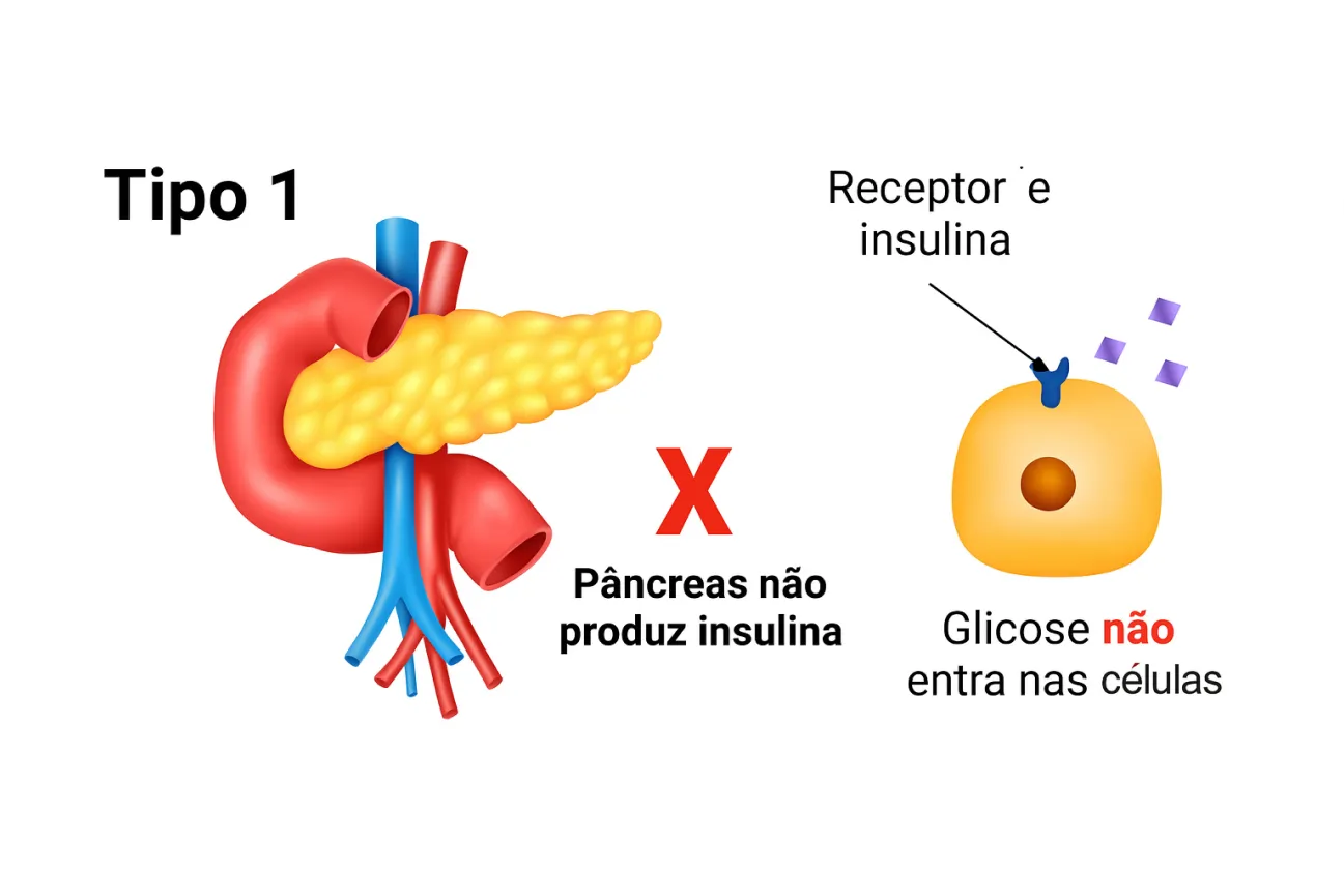 como-age-diabetes-tipo-1